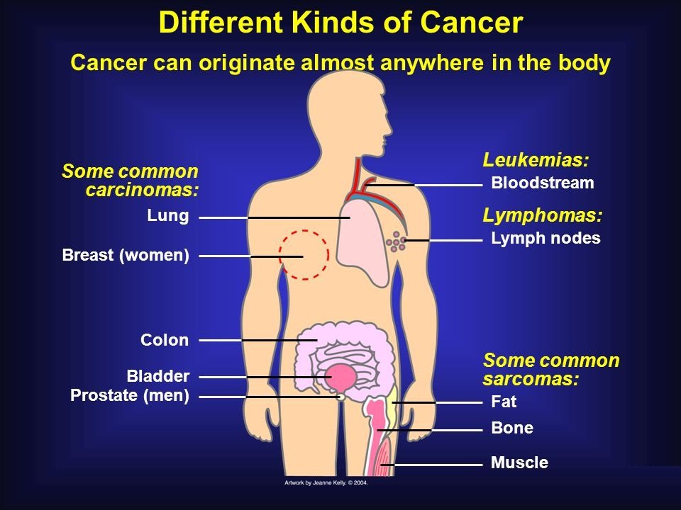 signs-and-symptoms-of-cancer